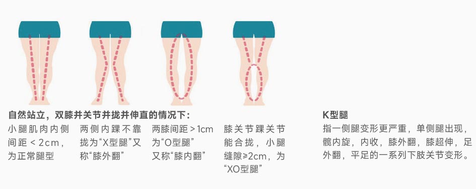 腿型參考范圍